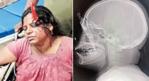 andhra-husband-attacks-wife-under-intoxication