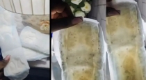 always-sanitary-pad-maggots-viral-video-issue