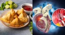 fast-food-heart-attack-warning-delhi-doctor
