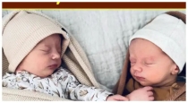 Uk-twin-sisters-dna-medical-rare-case