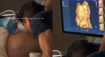 Baby-smiles-during-ultrasound-video-goes-viral