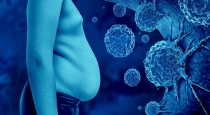 Can Obesity Increase Cancer Risk? Doctors Explain the Hidden Health Dangers