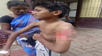 In-perambalur-minor-boy-affected-injection-issue-surger