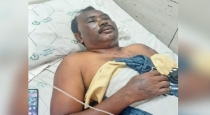 Tiruvarur Shocker: Teacher Attacked With Acid Amid Sexual Harassment Probe