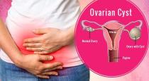  What causes uterine cyst problem and Solutions 