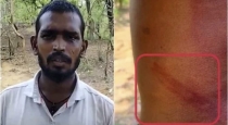 Telangana Youth Attacked by Cops 