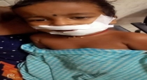 Cuddalore SriMushnam Boy Bite dogs Want Help Poor Family 