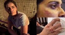 Tamil Actress Rashi kanna share bloodscene photos in instagram