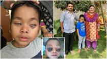 7-years-old-boy-lost-vision-and-get-it-back