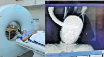 maharashtra-60-years-old-women-billhook-in-head