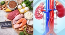 Does Eating Too Much Protein Damage Your Kidneys? Here