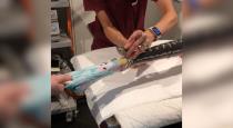 Doctors Pull Entire Beach Towel Out of Pythons Mouth