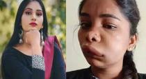 famous-actress-face-changed-after-treatment
