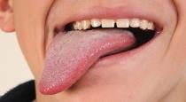 women cut her lover tongue