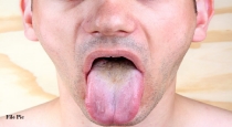 Chhattisgarh Man Cut Tongue 