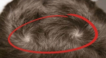 double-swirl-hair-myth-facts-tamil
