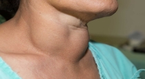 Hidden Dangers of Thyroid Disorders: How They Can Lead to High Blood Pressure