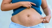 Do you want a flat stomach with no belly button after giving birth?... here it is for you..!!
