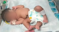 A woman gives birth to a baby girl with four legs 
