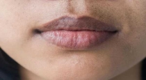 to-make-dry-dark-lips-soft-and-red-natural-methods