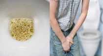 Foamy Urine May Signal Kidney Disease