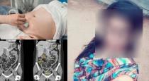 7th-standard-girl-got-pregnant-by-two-men-near-selam